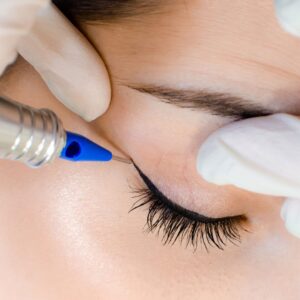 Eyeliner tattoo being applied to eye.