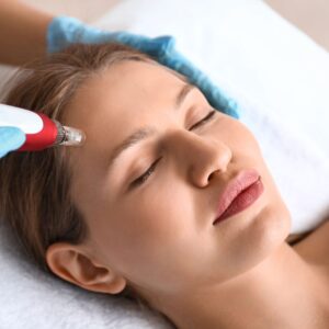 Woman receiving facial micro needling treatment.