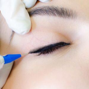 Eyeliner tattoo being applied to eye.