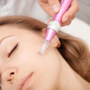 Derma roller being used on woman's face.