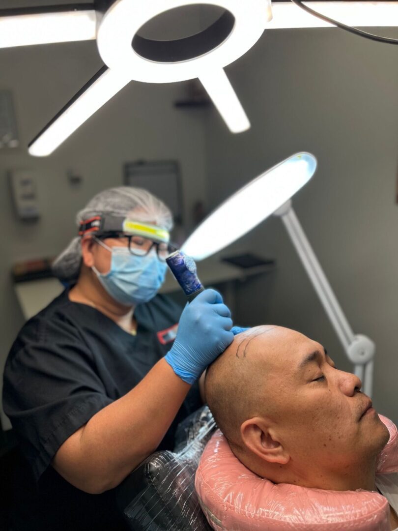 Scalp micropigmentation procedure in progress.