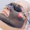 Charcoal Gel Peel Solution for Laser Rejuvenation 80ml