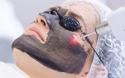 Charcoal Gel Peel Solution for Laser Rejuvenation 80ml